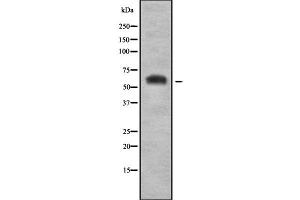 Western blot analysis SLC7A3 using HepG2 whole cell lysates (SLC7A3 抗体  (Internal Region))