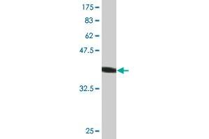 Western Blot detection against Immunogen (44. (AGR2 抗体  (AA 1-175))