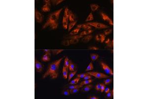 Immunofluorescence analysis of H9C2 cells using  Rabbit pAb (ABIN1678800, ABIN3019073, ABIN3019074 and ABIN6220701) at dilution of 1:100. (Ataxin 10 抗体  (AA 346-475))