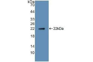 Western blot analysis of recombinant Human RANkL. (RANKL 抗体  (AA 79-247))