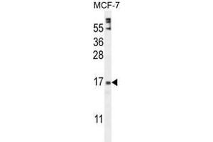 ZNF720 Antibody (Center) western blot analysis in MCF-7 cell line lysates (35 µg/lane). (ZNF720 抗体  (Middle Region))