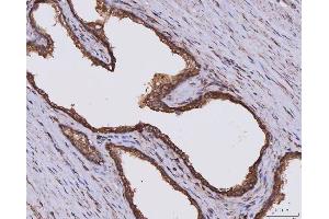 IHC analysis of CLASP1 using anti-CLASP1 antibody (ABIN7599144). (CLASP1 抗体  (AA 1-243))
