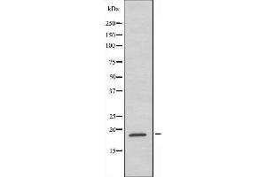 Western blot analysis of extracts from HeLa cells,using RPL35 antibody. (RPL35 抗体  (C-Term))