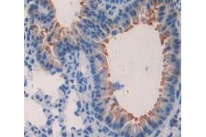 IHC-P analysis of Kidney tissue, with DAB staining. (Surfactant Protein C 抗体  (AA 1-193))