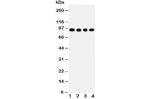 Western blot testing of ADAM17 antibody and Lane 1:  human placenta;  2: HeLa;  3: PANC;  4: 293T cell lysate.