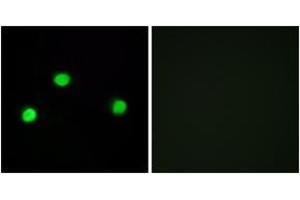 Immunofluorescence analysis of COS7 cells, using IP6K2 Antibody. (IP6K2 抗体  (AA 161-210))