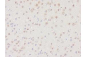 Formalin-fixed and paraffin embedded rat brain tissue labeled with Rabbit Anti-DHRS2 Polyclonal Antibody, Unconjugated (ABIN2559682) at 1:200 followed by conjugation to the secondary antibody and DAB staining (DHRS2 抗体  (AA 61-160))