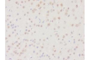 Formalin-fixed and paraffin embedded rat brain tissue labeled with Rabbit Anti-DHRS2 Polyclonal Antibody, Unconjugated (ABIN2559682) at 1:200 followed by conjugation to the secondary antibody and DAB staining (DHRS2 抗体  (AA 61-160))