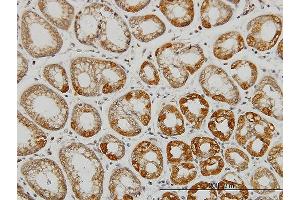 Immunoperoxidase of monoclonal antibody to AATK on formalin-fixed paraffin-embedded human stomach. (AATK 抗体  (AA 161-260))