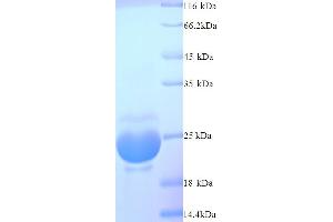 SDS-PAGE (SDS) image for OV16 (AA 17-197) protein (His tag) (ABIN5714124) (OV16 (AA 17-197) protein (His tag))