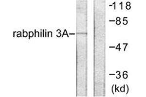 Western blot analysis of extracts from HeLa cells, treated with TNF-a 20ng/ml 2', using Rabphilin 3A (Ab-Ser237) Antibody. (RPH3A 抗体  (AA 203-252))