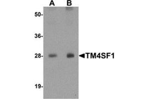 Western blot analysis of TM4SF1 in human lung tissue lysate with TM4SF1 antibody at (A) 0. (TM4SF1 抗体  (N-Term))