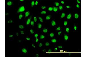 Immunofluorescence of monoclonal antibody to HELZ on HeLa cell. (HELZ 抗体  (AA 1-100))