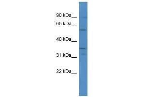 WB Suggested Anti-CA5A Antibody Titration: 0. (CA5A 抗体  (C-Term))