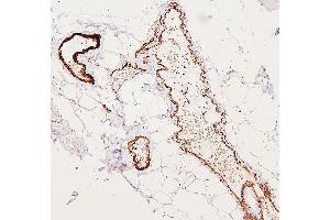 IHC analysis of FLNA using anti-FLNA antibody (ABIN7601782).