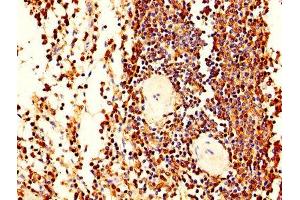 IHC image of ABIN7163556 diluted at 1:400 and staining in paraffin-embedded human spleen tissue performed on a Leica BondTM system. (LCP1 抗体  (AA 2-627))