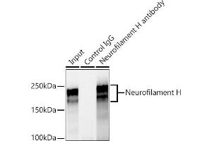Immunoprecipitation analysis of 600 μg extracts of Rat brain cells using 3 μg Neurofilament H antibody (ABIN7268866). (NEFH 抗体)