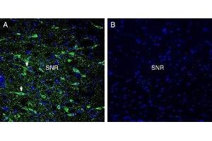 Expression of GPR52 in rat substantia nigra - Immunohistochemical staining of perfusion-fixed frozen rat brain sections with Anti-GPR52 Antibody (ABIN7043161, ABIN7044453 and ABIN7044454), (1:300), followed by goat anti-rabbit-AlexaFluor-488. (GPR52 抗体  (3rd Intracellular Loop))