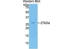 Western blot analysis of the recombinant protein. (Coagulation Factor IX 抗体  (AA 241-463))