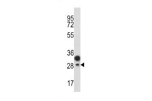 Western blot analysis of CD201 antibody in T47D cell line lysates (35ug/lane) (PROCR 抗体  (AA 104-132))