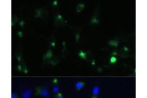 Immunofluorescence (IF) image for anti-Enolase 1 (ENO1) antibody (ABIN7259410)