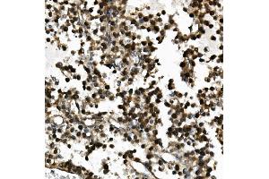 IHC analysis of USP44 using anti-USP44 antibody (ABIN7600640). (USP44 抗体  (AA 211-712))