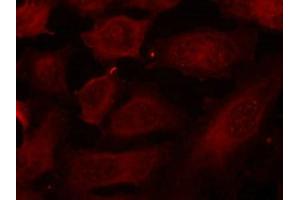 Immunofluorescence staining of methanol-fixed Hela cells using p56Dok-2(Phospho-Tyr299) Antibody. (DOK2 抗体  (pTyr299))