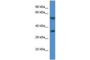 Image no. 1 for anti-Mitochondrial Ribosomal Protein L45 (MRPL45) (C-Term) antibody (ABIN6746836) (MRPL45 抗体  (C-Term))