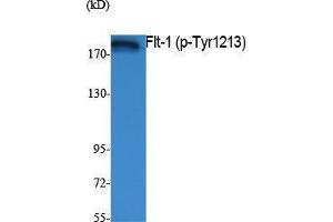 Western Blotting (WB) image for anti-Fms-Related tyrosine Kinase 1 (VEGFR1) (FLT1) (pTyr1213) antibody (ABIN3179854) (FLT1 抗体  (pTyr1213))