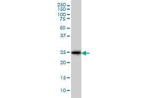 CD99 monoclonal antibody (M01), clone 3A10 Western Blot analysis of CD99 expression in K-562 . (CD99 抗体  (AA 23-122))