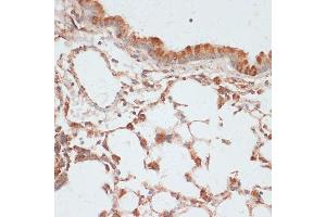 Immunohistochemistry of paraffin-embedded mouse lung using Phospho-VASP-S157 antibody (ABIN6135335, ABIN6136286, ABIN6136287 and ABIN6225657) at dilution of 1:100 (40x lens). (VASP 抗体  (pSer157))