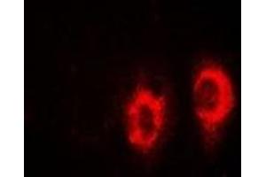 Immunofluorescent analysis of UBE2H staining in SW480 cells. (UBE2H 抗体)