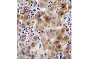 Immunohistochemistry analysis in formalin fixed and paraffin embedded human liver tissue reacted with NEU2 Antibody (N-term) followed which was peroxidase conjugated to the secondary antibody and followed by DAB staining. (NEU2 抗体  (N-Term))
