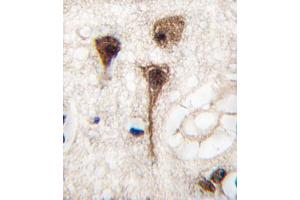 Formalin-fixed and paraffin-embedded human brain tissue reacted with MEF2C Antibody , which was peroxidase-conjugated to the secondary antibody, followed by DAB staining. (MEF2C 抗体  (AA 278-307))