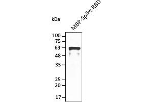 Western Blotting (WB) image for anti-SARS-CoV-2 Spike (RBD) antibody (ABIN7272992) (SARS-CoV-2 Spike 抗体  (RBD))