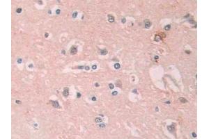Immunohistochemistry (IHC) image for anti-PTK7 Protein tyrosine Kinase 7 (PTK7) (AA 853-1070) antibody (ABIN7445414)