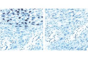 Immunohistochemistry (IHC) image for anti-L1 Protein antibody (ABIN967423) (L1 Protein 抗体)