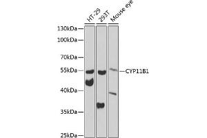 Western blot analysis of extracts of various cell lines, using CYP11B1 antibody (ABIN6130956, ABIN6139312, ABIN6139313 and ABIN6223585) at 1:1000 dilution. (CYP11B1 抗体  (AA 234-503))