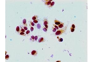 Immunocytochemistry analysis of MCF-7 cells using ABIN7139163 at dilution of 1:100 (HIST1H1E 抗体  (acLys16))