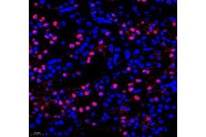 Immunofluorescence of paraffin embedded mouse kidney using Adenosine kinase (ABIN7072953) at dilution of 1: 300 (400x lens) (ADK 抗体)