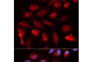 Immunofluorescence analysis of U2OS cells using PPARD Polyclonal Antibody (PPARD 抗体)