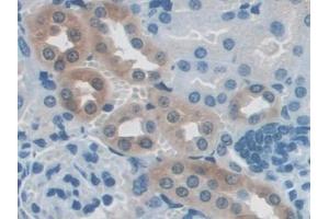 Immunohistochemistry (IHC) image for anti-Nucleoredoxin (NXN) (AA 167-435) antibody (ABIN7439750)