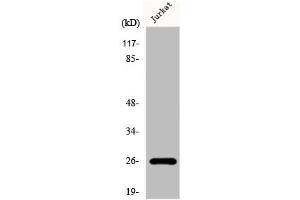 Western Blot analysis of Jurkat cells using Flt3-L Polyclonal Antibody (FLT3LG 抗体  (C-Term))