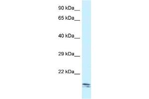 WB Suggested Anti-Sec11c Antibody Titration: 1. (SEC11C 抗体  (C-Term))