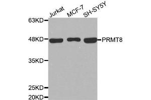 Western blot analysis of extracts of various cell lines, using PRMT8 antibody. (PRMT8 抗体)