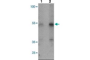 Western blot analysis of KREMEN2 in HeLa cell lysate with KREMEN2 polyclonal antibody  at (lane 1) 1 and (lane 2) 2 ug/mL. (KREMEN2 抗体  (C-Term))