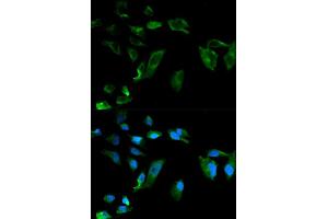 Immunofluorescence analysis of HeLa cells using NEK8 antibody (ABIN5970372). (NEK8 抗体)