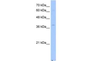 Western Blotting (WB) image for anti-NAD(P) Dependent Steroid Dehydrogenase-Like (NSDHL) antibody (ABIN2463049) (NSDHL 抗体)