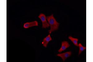 ABIN6260668 and ABIN6272272 staining HepG2 by IF/ICC. (CDC16 抗体  (Internal Region))