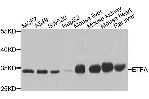 Western blot analysis of extracts of various cell lines, using ETFA antibody (ABIN5975750) at 1/1000 dilution. (ETFA 抗体)